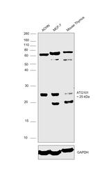 ATG101 Antibody in Western Blot (WB)