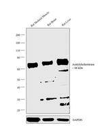 Acetylcholinesterase Antibody in Western Blot (WB)