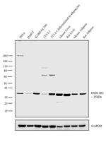 HSD11B1 Antibody in Western Blot (WB)