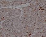 Arginase 1 Antibody in Immunohistochemistry (IHC)