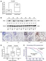 PPA1 Antibody in Western Blot, Immunohistochemistry (WB, IHC)