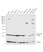LAMTOR3 Antibody in Western Blot (WB)