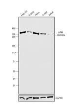 ATM Polyclonal Antibody, DyLight™ 488