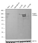 53BP1 Antibody in Western Blot (WB)