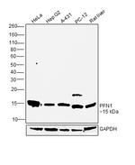 Profilin 1 Antibody in Western Blot (WB)