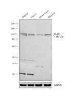 GLDC Polyclonal Antibody