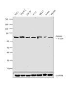 Artemis Antibody in Western Blot (WB)