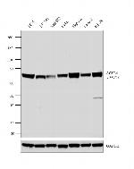 ACSL4 Antibody in Western Blot (WB)
