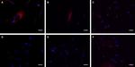HTR2C Antibody in Immunocytochemistry (ICC/IF)
