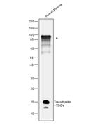 Transthyretin Polyclonal Antibody
