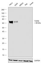 TGFBI Polyclonal Antibody