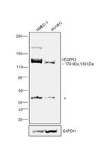 VEGF Receptor 3 Antibody in Western Blot (WB)