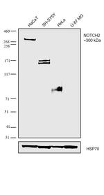 NOTCH2 Polyclonal Antibody