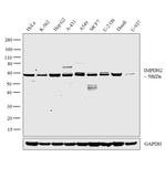 IMPDH2 Antibody in Western Blot (WB)