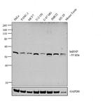 hnRNP K Antibody in Western Blot (WB)