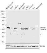 PHGDH Antibody in Western Blot (WB)