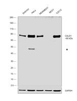 Caldesmon Antibody in Western Blot (WB)