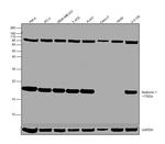 Stathmin 1 Antibody in Western Blot (WB)