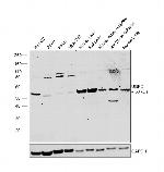 UGP2 Polyclonal Antibody