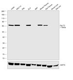 Zap-70 Antibody in Western Blot (WB)
