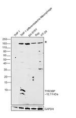 TYROBP Antibody in Western Blot (WB)