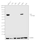TdT Polyclonal Antibody