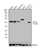 Cytokeratin 7 Antibody in Western Blot (WB)