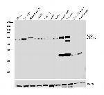 PAK3 Polyclonal Antibody