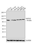 SAP102 Antibody in Western Blot (WB)