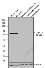 ATP6V1A Antibody in Western Blot (WB)