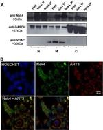 SLC25A6 Antibody in Immunocytochemistry (ICC/IF)