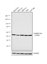 CaMKII beta Antibody in Western Blot (WB)