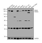 MSH6 Antibody in Western Blot (WB)