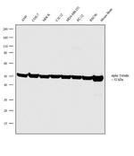 TUBA4A Antibody in Western Blot (WB)