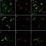SSB Antibody in Immunocytochemistry (ICC/IF)