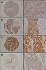 UHRF1 Antibody in Immunohistochemistry (IHC)