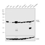 ACAA1 Antibody in Western Blot (WB)
