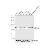 PPA1 Polyclonal Antibody