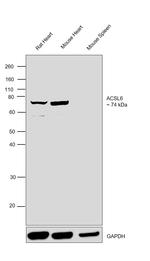 ACSL6 Antibody in Western Blot (WB)