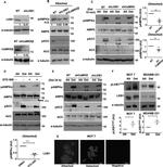 CaMKK beta Antibody in Western Blot (WB)