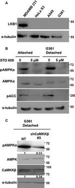 CaMKK beta Antibody in Western Blot (WB)