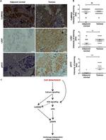 CaMKK beta Antibody in Immunohistochemistry (IHC)