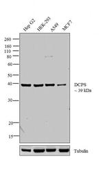 DCPS Antibody in Western Blot (WB)