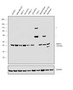 GNA11 Polyclonal Antibody