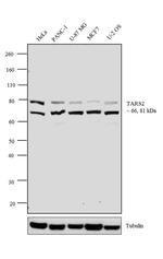 TARS2 Antibody in Western Blot (WB)