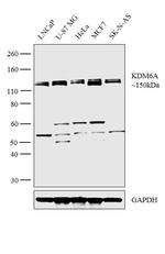 KDM6A Polyclonal Antibody