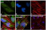 PHD1 Antibody in Immunocytochemistry (ICC/IF)