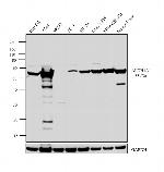ALDH1A1 Antibody
