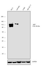 beta Amyloid Antibody in Western Blot (WB)