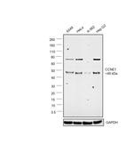Cyclin E Antibody in Western Blot (WB)